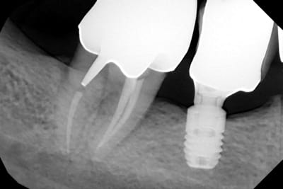 Tmbio5tsfirad5a8jjmtmd50jmqq - Eugenol