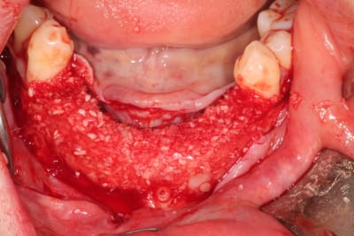 Travail 009 z46vcf - Eugenol