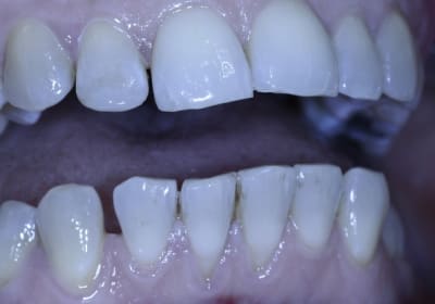 Trop clair isbf8o - Eugenol