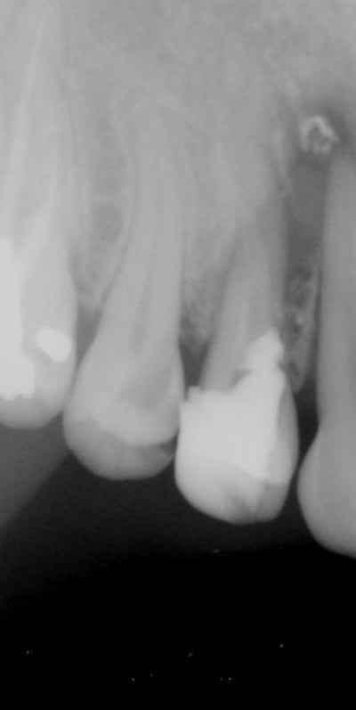 Trucmuche zoqqjq - Eugenol