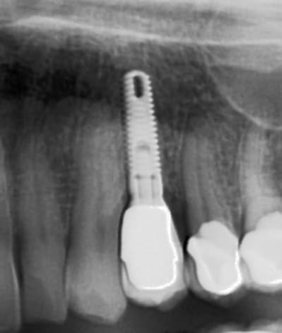 Tsv pwt9qy - Eugenol
