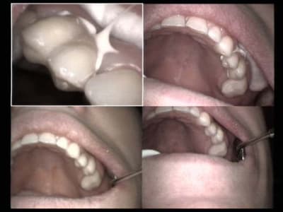 Un autre beau cas haut gauche fin 2 jjxepy - Eugenol