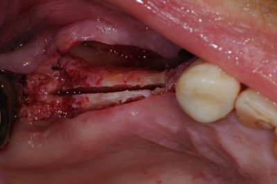 Uuwywjkxkz7vnli9ayvn - Eugenol