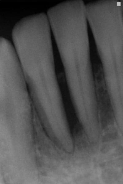 Ver juil06 ffxdpk - Eugenol