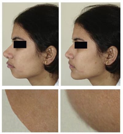 Vinette vudoax - Eugenol