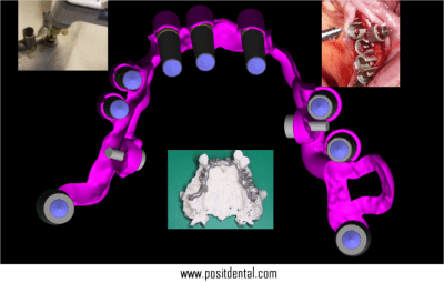 Vis s cable sxle7a - Eugenol