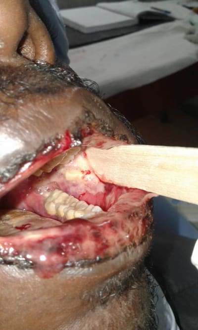 Vojvrlozbot1zxb57z1v - Eugenol