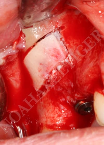 Volet repositionn  gafd4t - Eugenol