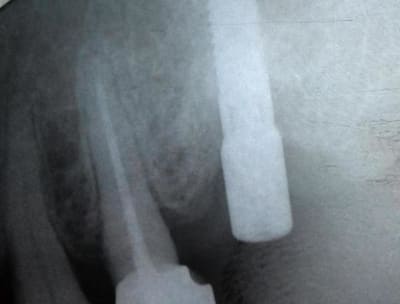 Vp15 cunmkg - Eugenol