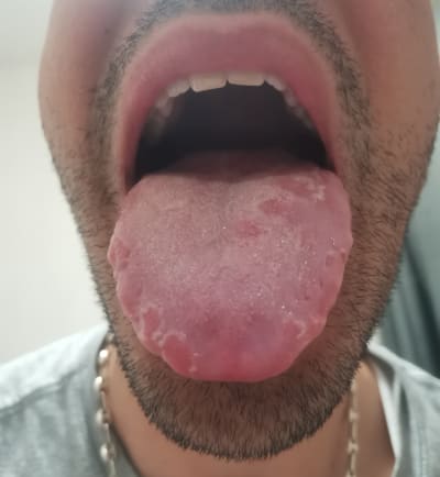 Vppjmss2ca18uvgexqzky4ypf5ps - Eugenol