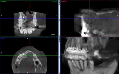 Vue 2 neux3p - Eugenol