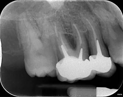 X4biz1cnvprt82l5hx4q - Eugenol