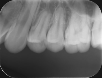 X8yuibepnjmohlxgu5g9 - Eugenol