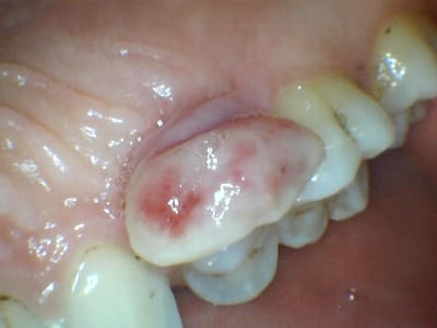 Xdvgqtuudhs45ppbxg3r - Eugenol