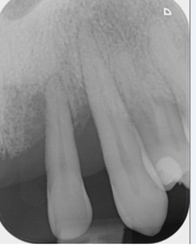 Xlvj03kubm3qxbxrwpwa - Eugenol