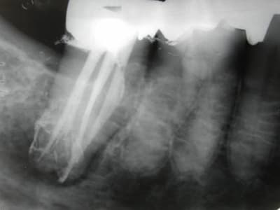 Yana hvcoi6 - Eugenol