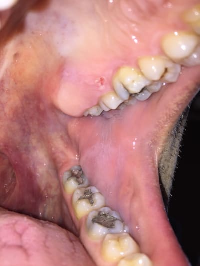 Ylvz8acph2rtula6tuw2 - Eugenol