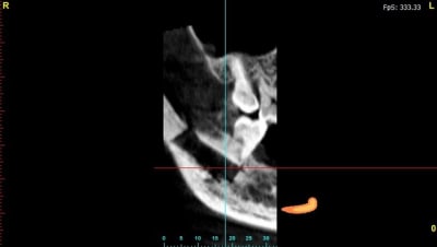 Youssouf panoramic1 nzlj3a - Eugenol
