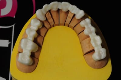 Zirconeocclusal csb7a2 - Eugenol