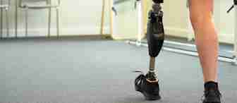 A person with a prosthetic leg, wearing black shorts and black sneakers, walks indoors on a carpeted floor; two empty chairs are visible in the background.