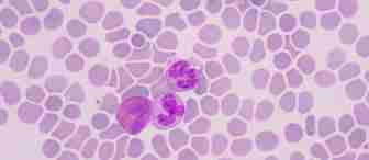 A microscopic view of a blood smear showing numerous red blood cells with three visible white blood cells stained purple. The cells are evenly distributed across the field with distinct shapes and sizes. The background is light pink.