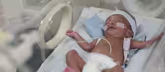 A premature baby lies in an incubator, wearing a diaper and a hospital wristband, with medical tubes and a sensor attached for monitoring. The baby appears to be sleeping or resting.