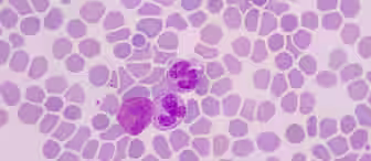 A microscopic view of a blood smear showing numerous red blood cells with three visible white blood cells stained purple. The cells are evenly distributed across the field with distinct shapes and sizes. The background is light pink.