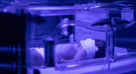 A newborn baby lies in an incubator under blue phototherapy light, wearing an eye shield for protection. The scene appears to be in a hospital neonatal unit.