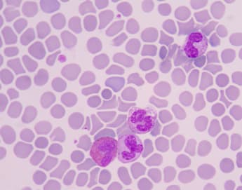 A microscopic view of a blood smear showing numerous red blood cells with three visible white blood cells stained purple. The cells are evenly distributed across the field with distinct shapes and sizes. The background is light pink.