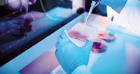 A gloved scientist uses a pipette to add liquid to a 96-well plate in a laboratory. Scientific equipment and a computer screen displaying chemical formulas are visible in the background, highlighting a research environment.
