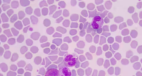 A microscopic view of a blood smear showing numerous red blood cells with three visible white blood cells stained purple. The cells are evenly distributed across the field with distinct shapes and sizes. The background is light pink.