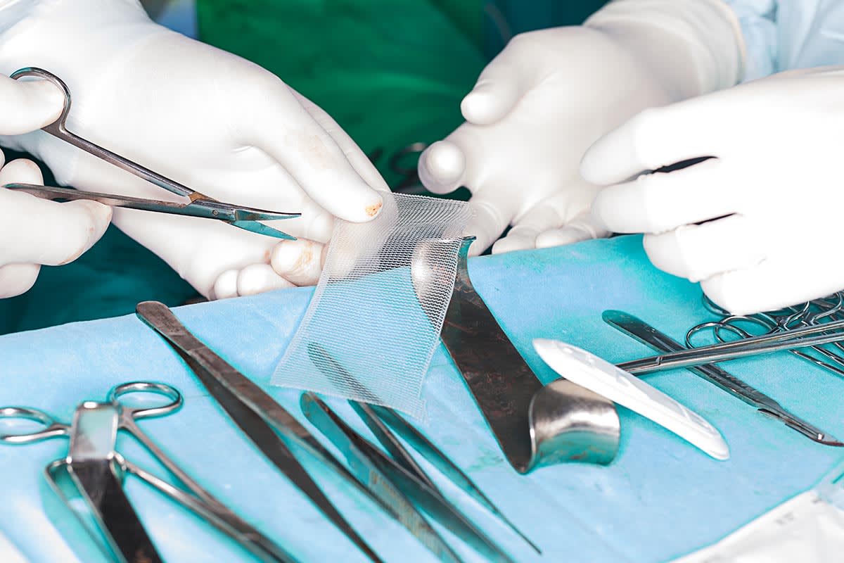 Pelvic Mesh Injury After LVMR Surgery Causes Lasting Harm