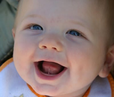 CÁCH ĐIỀU TRỊ DÍNH THẮNG LƯỠI Ở TRẺ. KHI NÀO CON CẦN PHẪU THUẬT DÍNH THẮNG LƯỠI?