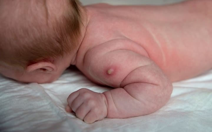 NHỮNG PHẢN ỨNG CỦA TRẺ SAU TIÊM PHÒNG BA MẸ CẦN LƯU Ý