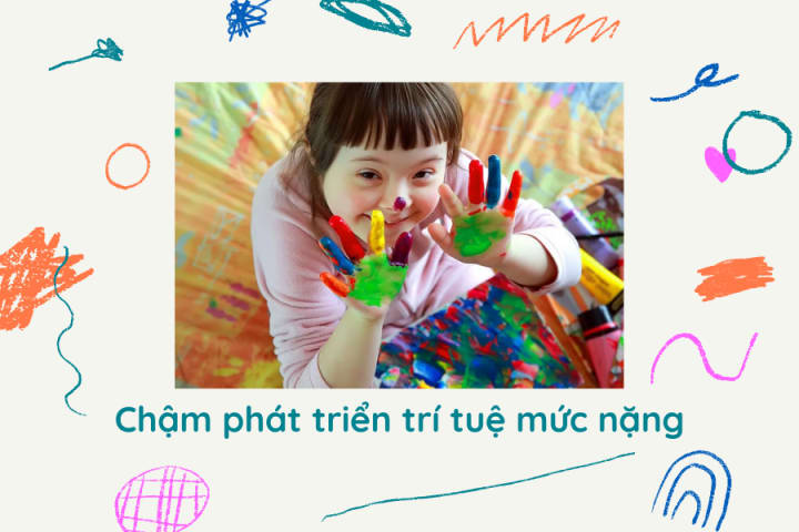 NHẬN BIẾT BIỂU HIỆN TRẺ CHẬM PHÁT TRIỂN TRÍ TUỆ
