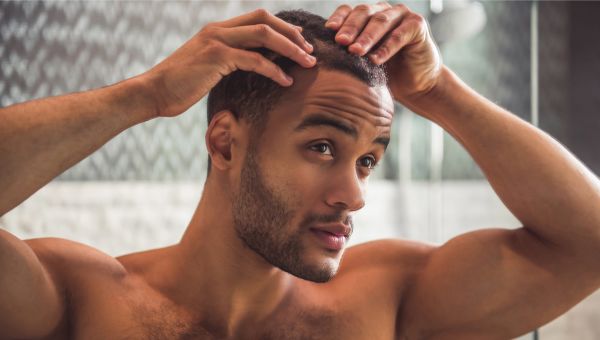 balding, male pattern baldness, hair loss, skin care