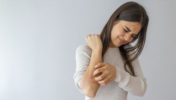 Simple lifestyle changes can go a long way in helping you manage atopic dermatitis. 