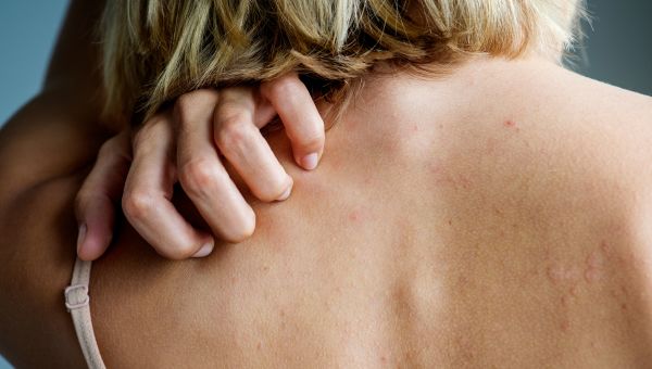 nails scratching back