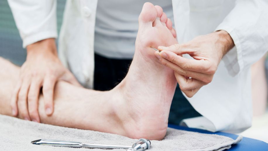 Doctor testing the sensitivity of a patient's foot