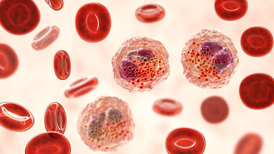 Blood smear showing multiple eosinophils surround by red blood cells