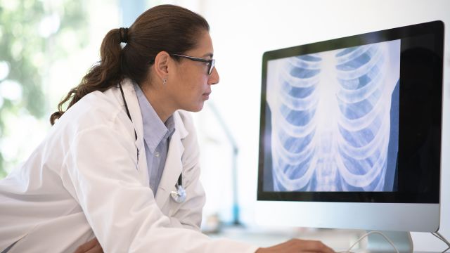 A doctor looking at x-rays to determine the effects of lung cancer.