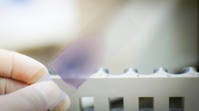 A blood smear test to look for abnormalities in blood cells. This test is used to help diagnose CML.