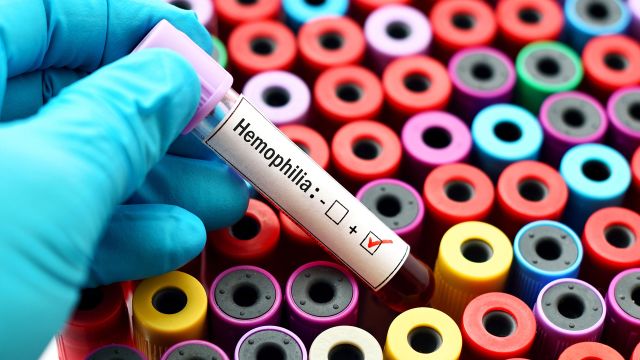 A vial of blood ready to be tested for hemophilia.