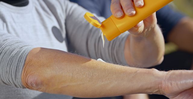 A man putting on sunscreen to protect from basal cell carcinoma.