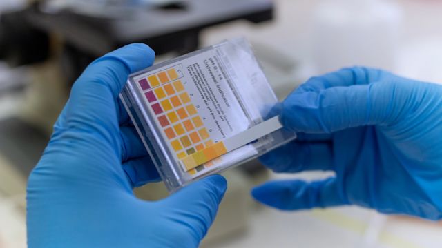 Closeup of a pair of gloved hands checking the results of a urinalysis test in a lab.