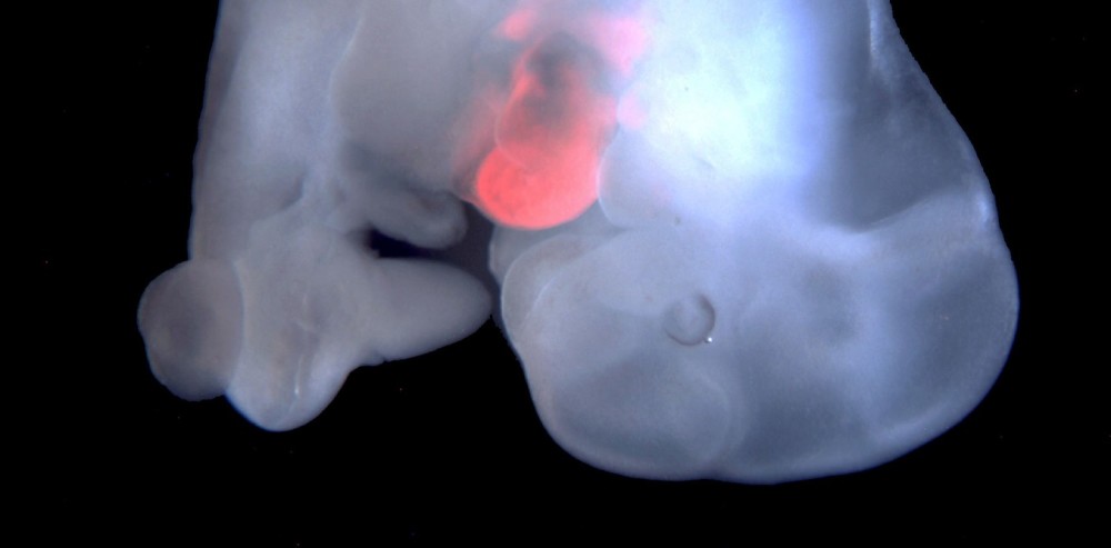Growing Organs in a Dish: Sci-Fi to Reality?