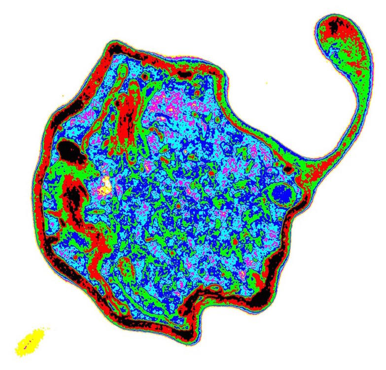 Trapping Malaria In A Gene Net Pursuit By The University Of Melbourne