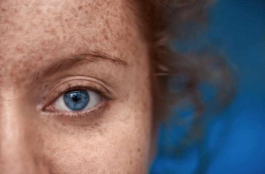 Are Redheads With Blue Eyes Really Going Extinct? | Pursuit By The  University Of Melbourne