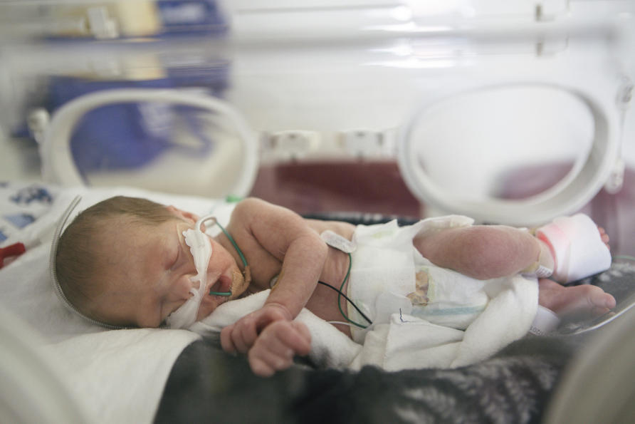 preemie ventilator